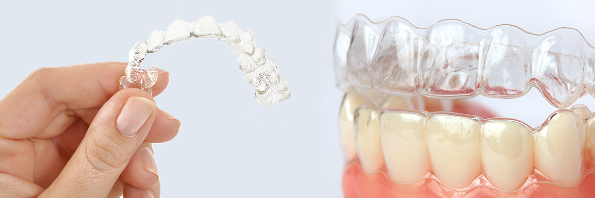 Houston Alternative to Braces for Teens