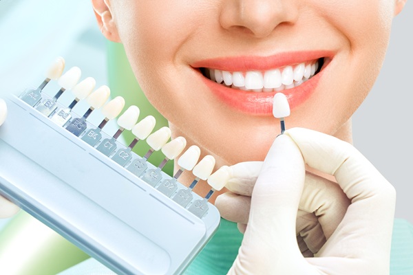 How Dentists Can Make Dental Veneers Look More Natural