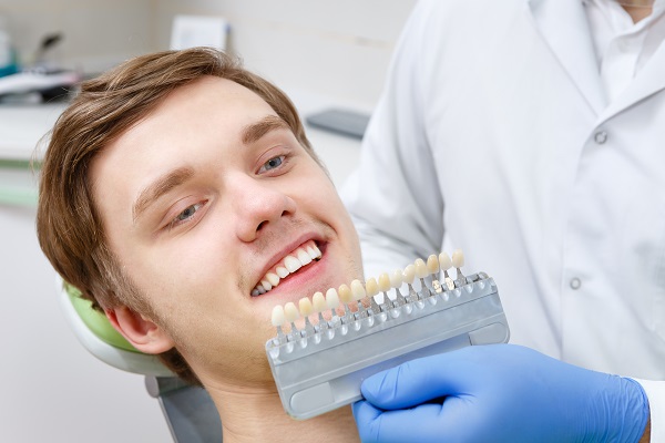 How Long Will Dental Veneers Last?