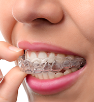 Clear Aligners - Almost Invisible Braces Houston, TX