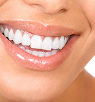 Teeth Whitening Services Houston, TX
